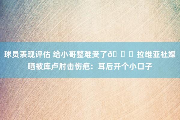 球员表现评估 给小哥整难受了😅拉维亚社媒晒被库卢肘击伤疤：耳后开个小口子